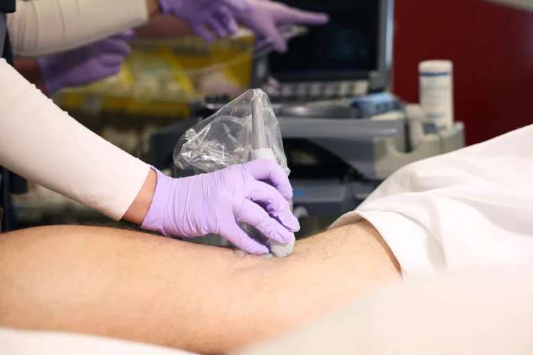 ultrasound guided nerve blocks
